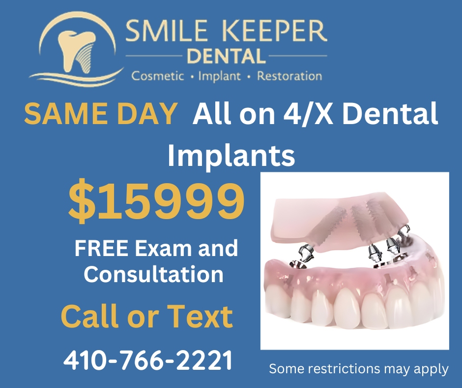 Smile Keeper Dental Implant Dentist ad creative