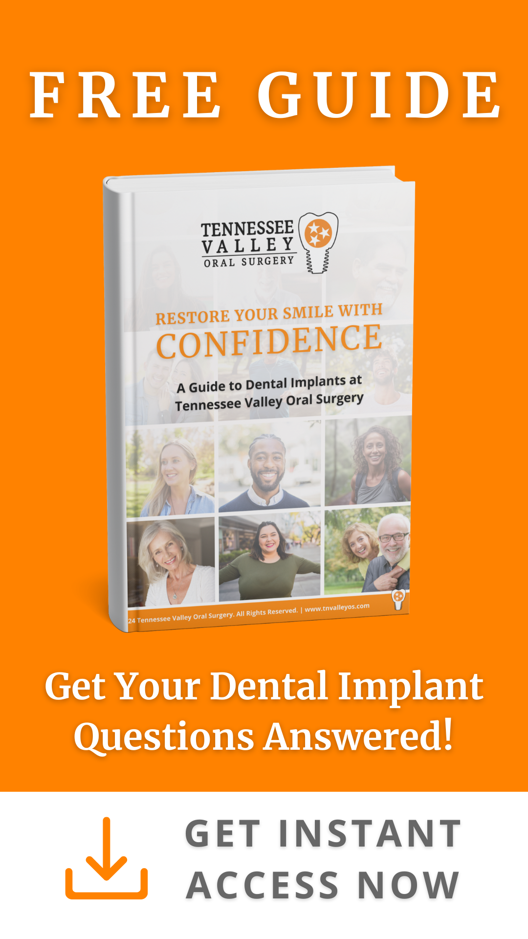 Get Your Questions About Dental Implants Answered Now