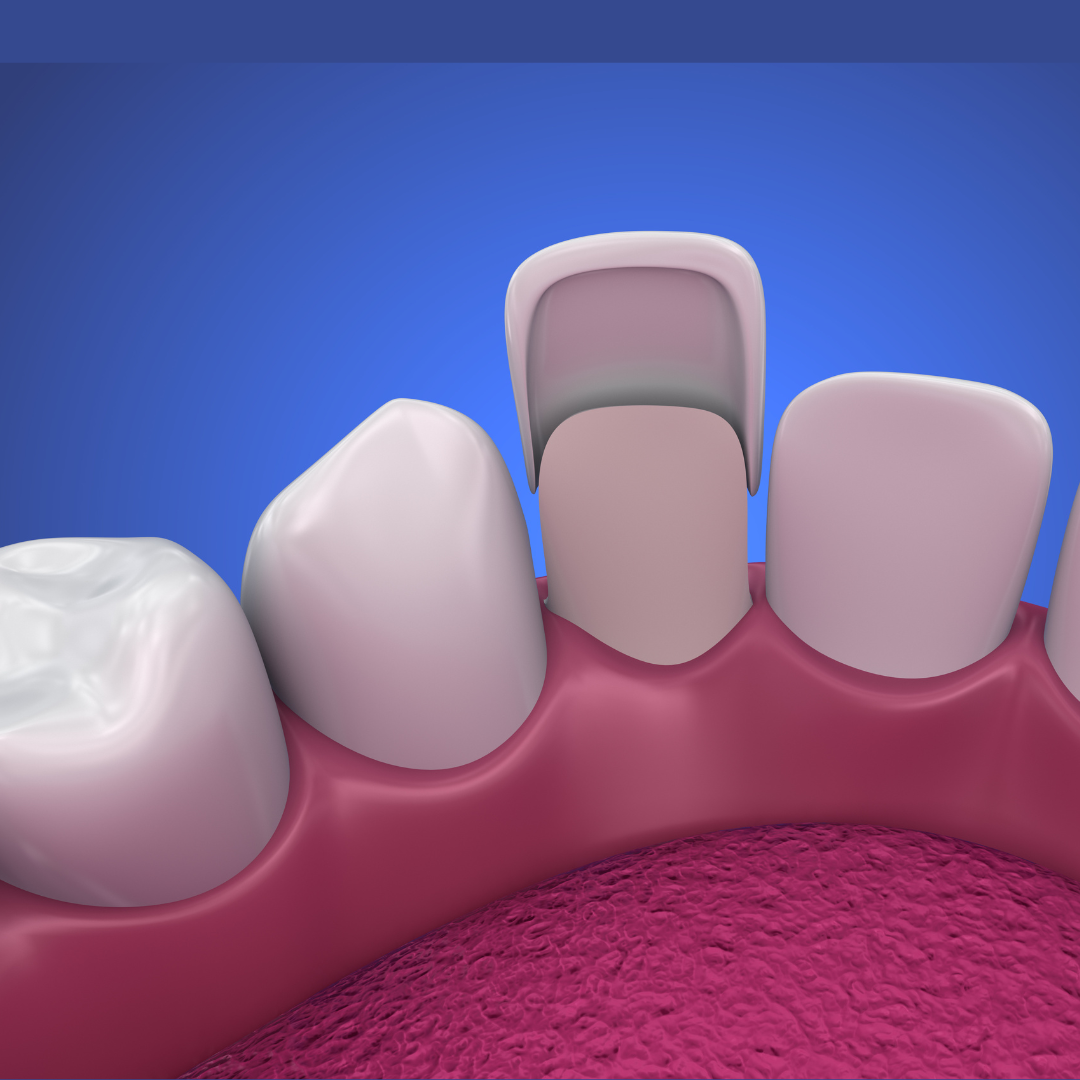 Harrison Implant and Family Dentistry Cosmetic Dentist ad creative