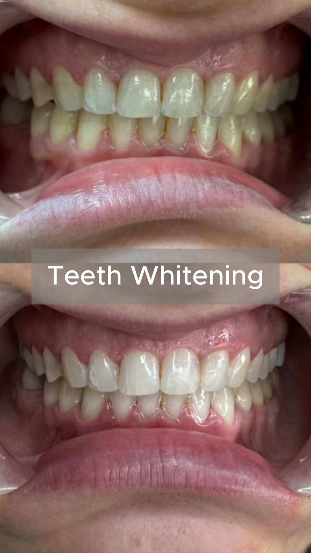 Sculpt Your Body By Ani Med Spa ad creative