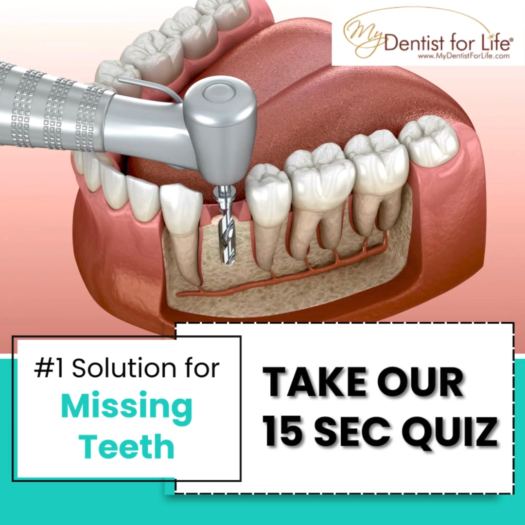 Transform Your Smile in One Day!