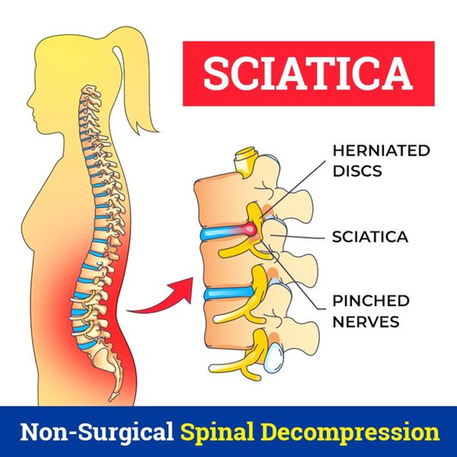 Gaithersburg Laser Pain Center - MD Chiropractor ad creative