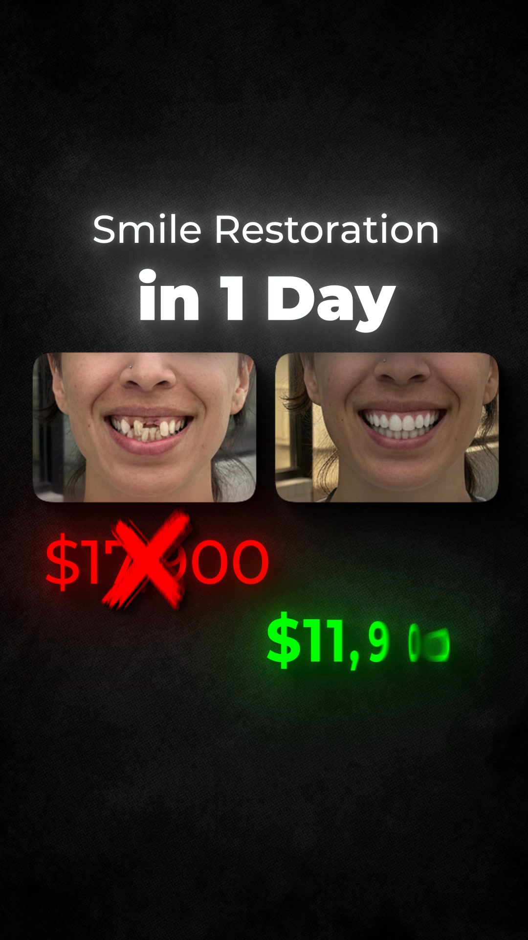 Central Valley Dentistry Implant Dentist ad creative