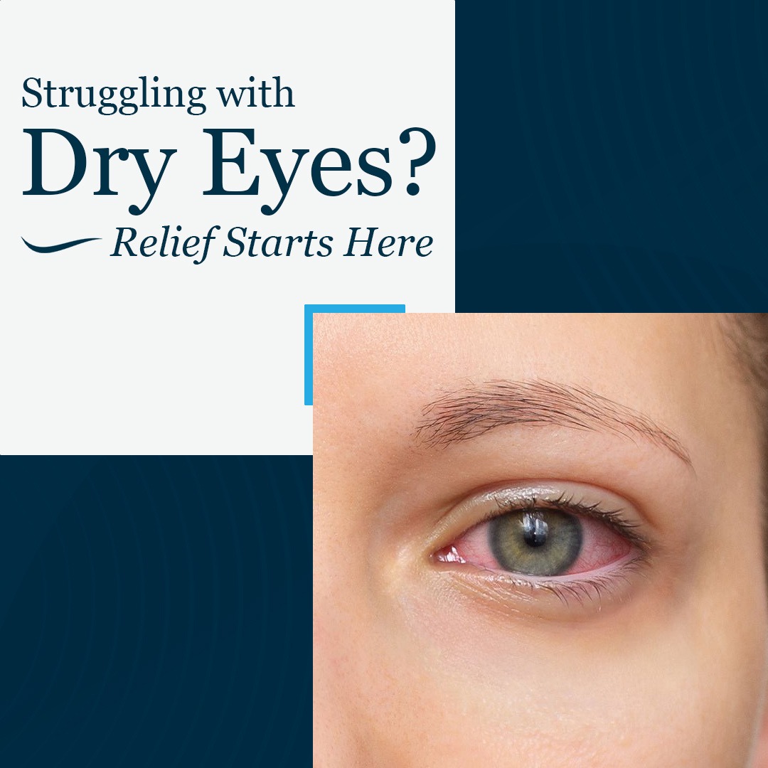 Try Our Dry Eye Self-Test