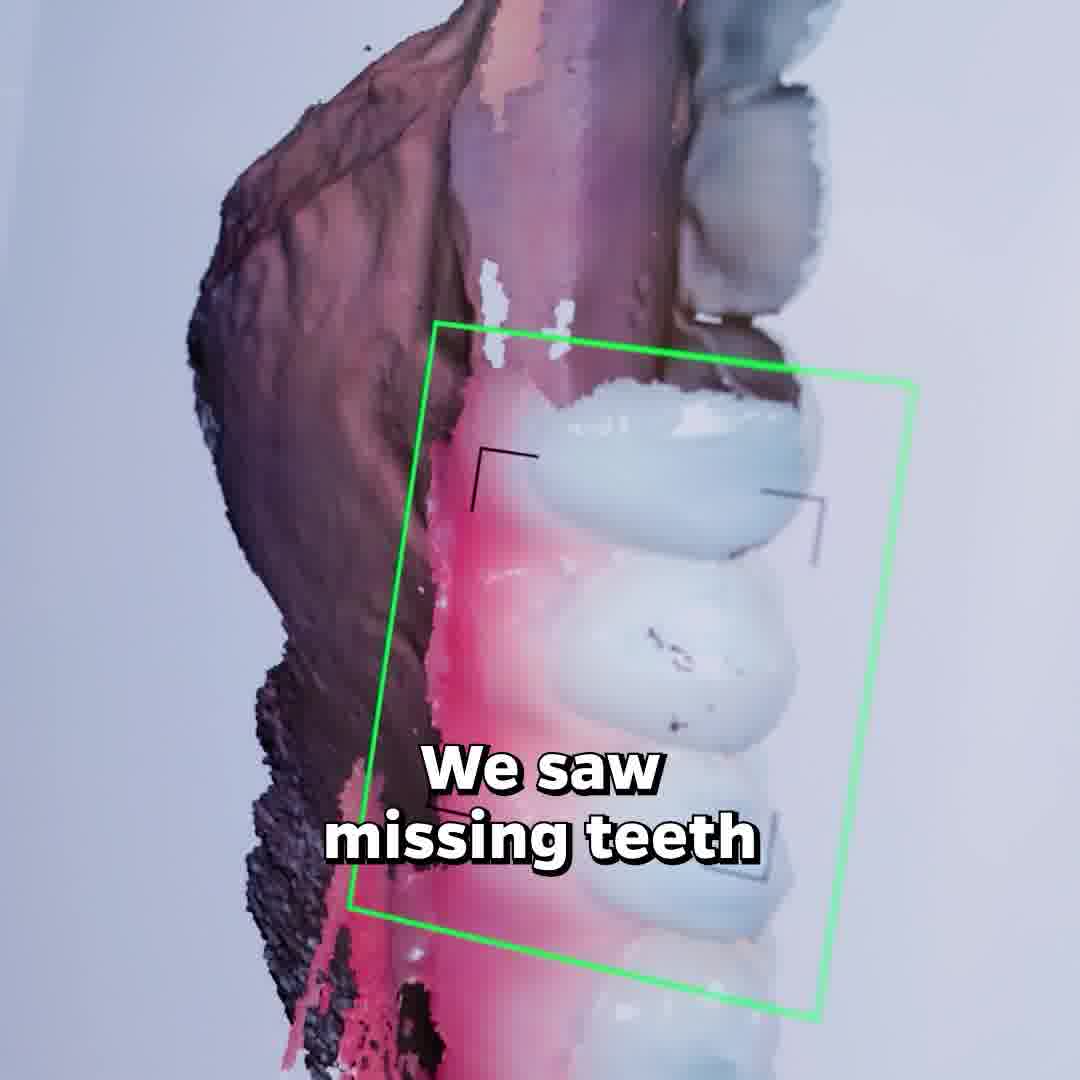 Georgia Implants and Dentures Implant Dentist ad creative