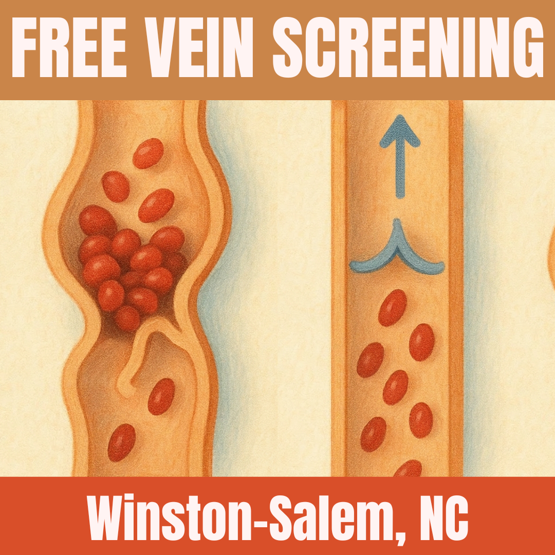 Get Your FREE In-Person Vein Screening