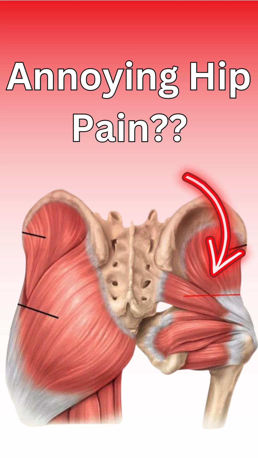 Tired of Youtube Videos NOT Solving Your Hip Pain?