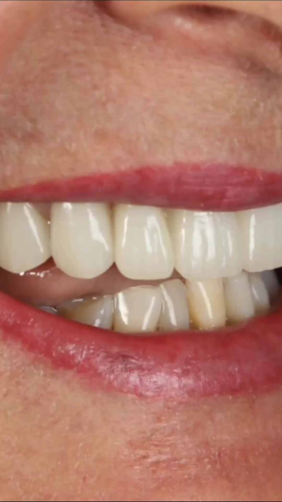 Book Your $283 Implant Consultation Today