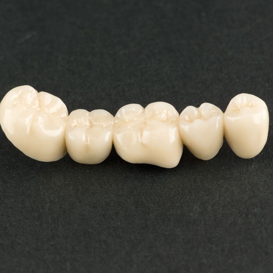 Prime Smile Dental | Smith With Confidence