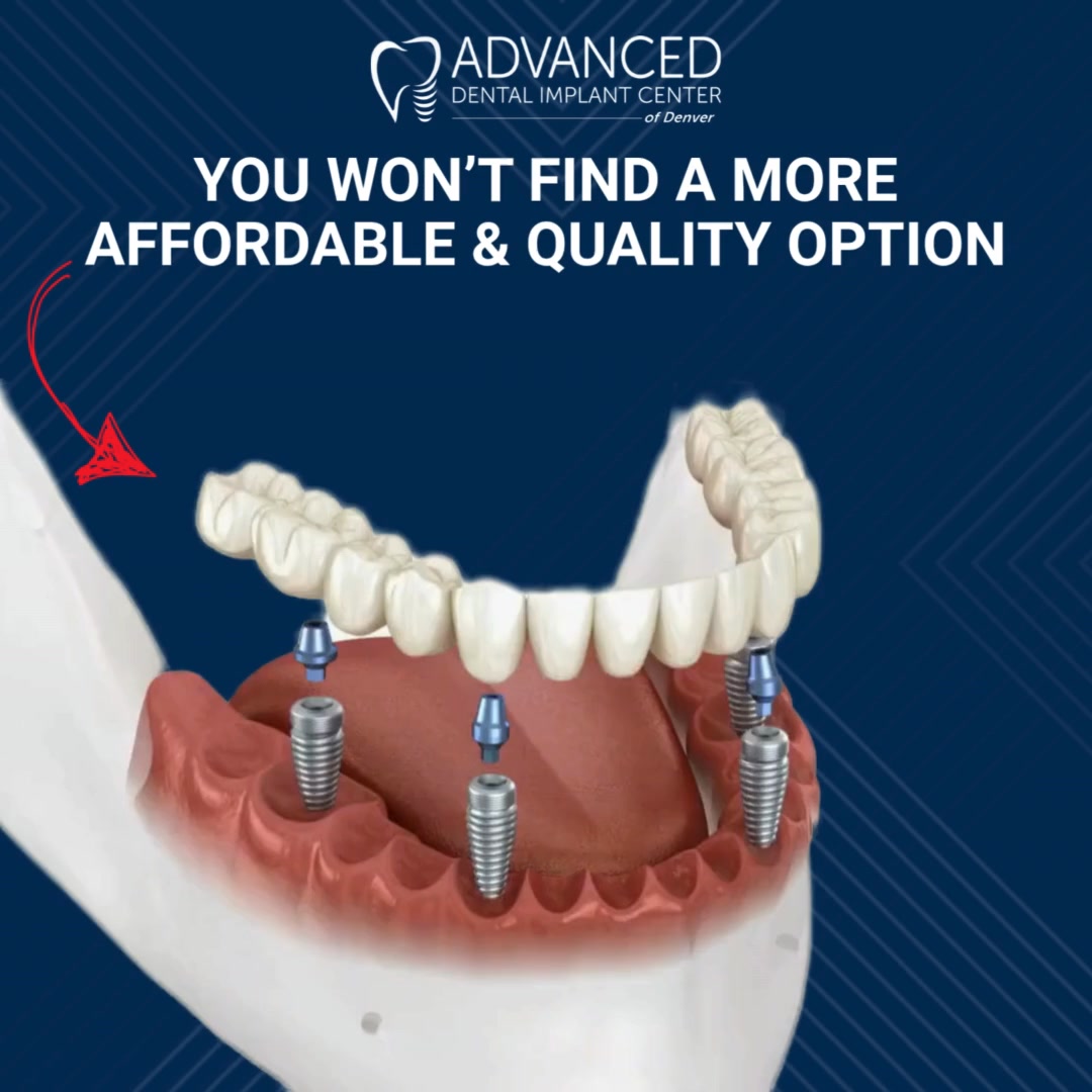 New Teeth. New Beautiful Smile.