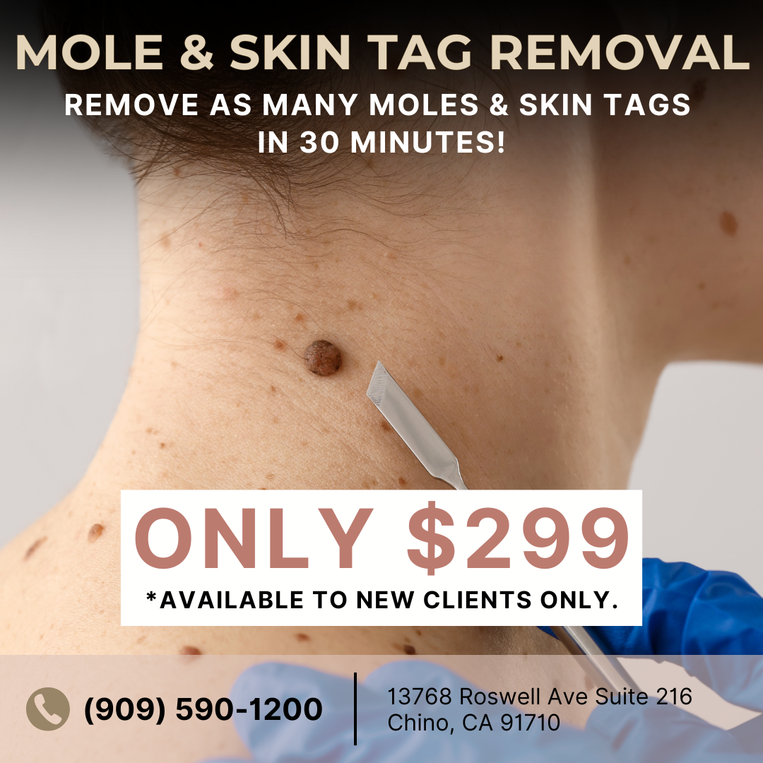 Bella Sol Med Spa Med Spa ad creative