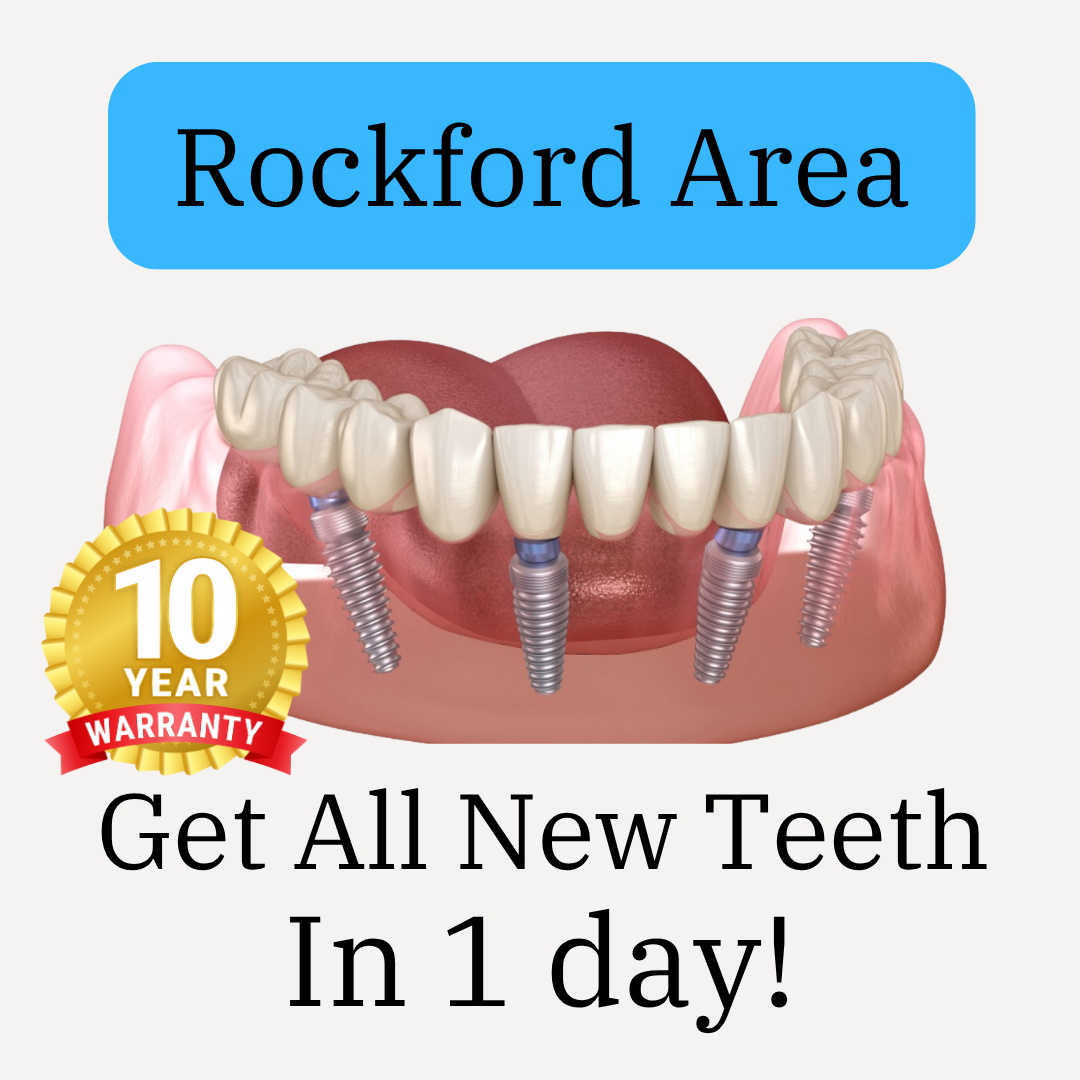 Bonvallet Dental Implant Dentist ad creative