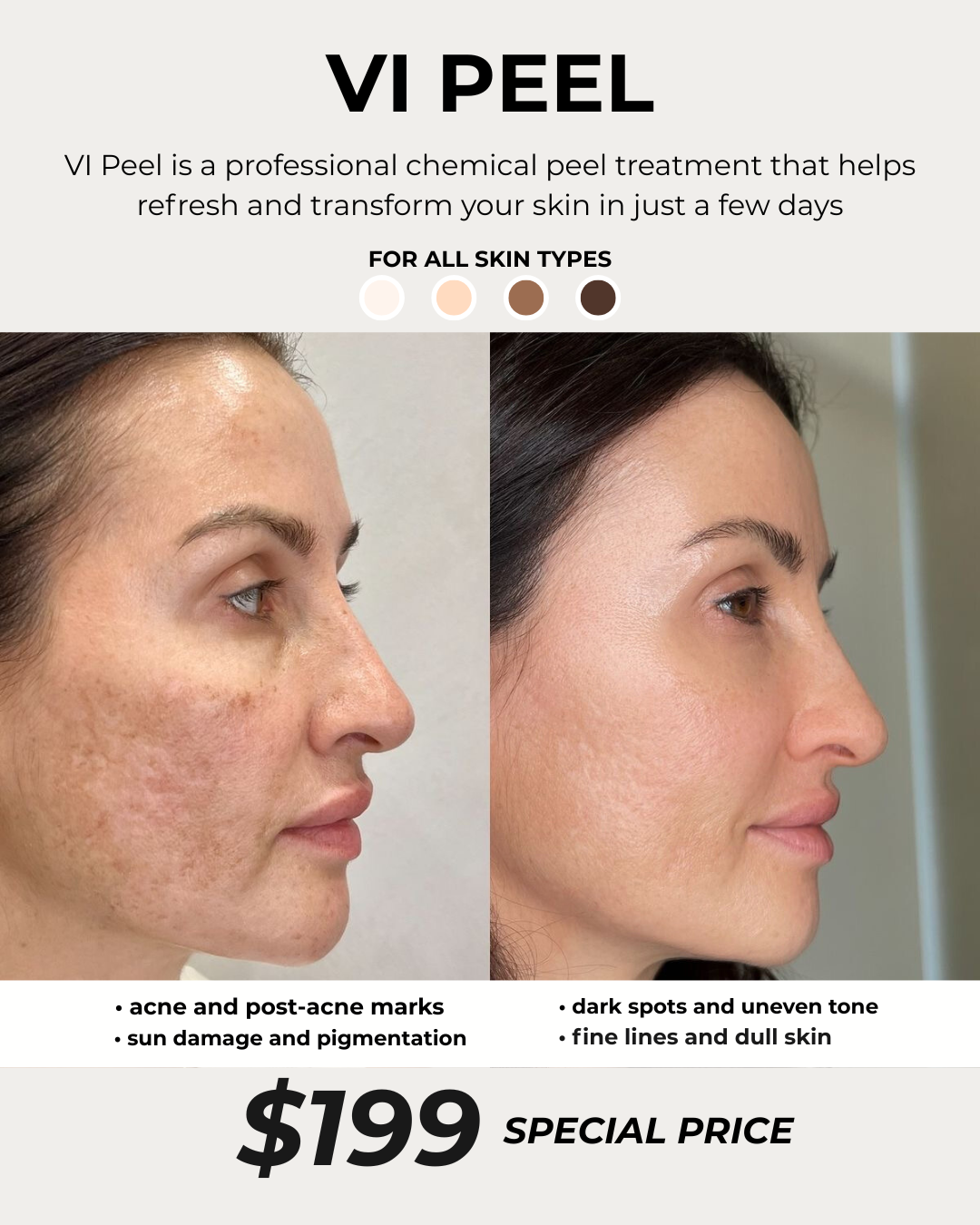 I Laser you NYC Med Spa ad creative