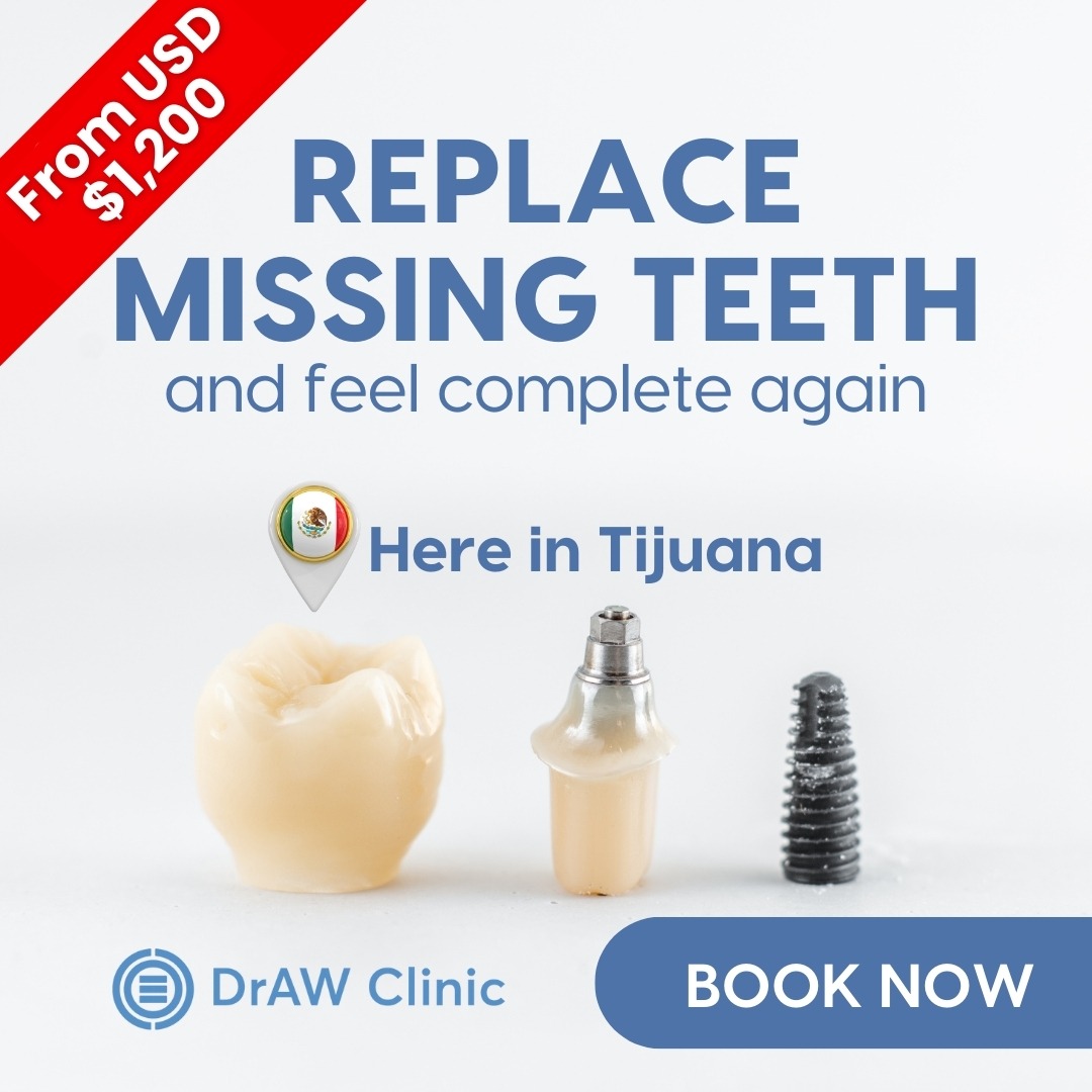 DRAW Dental Clinic - Maxillofacial Surgery and Implantology Implant Dentist ad creative