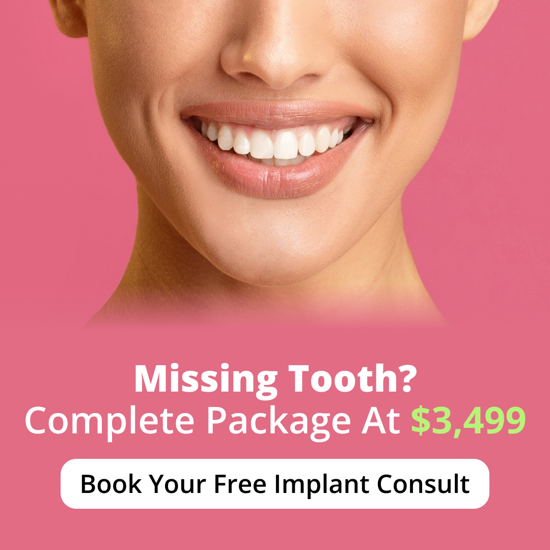 Camden Dental Implant Dentist ad creative