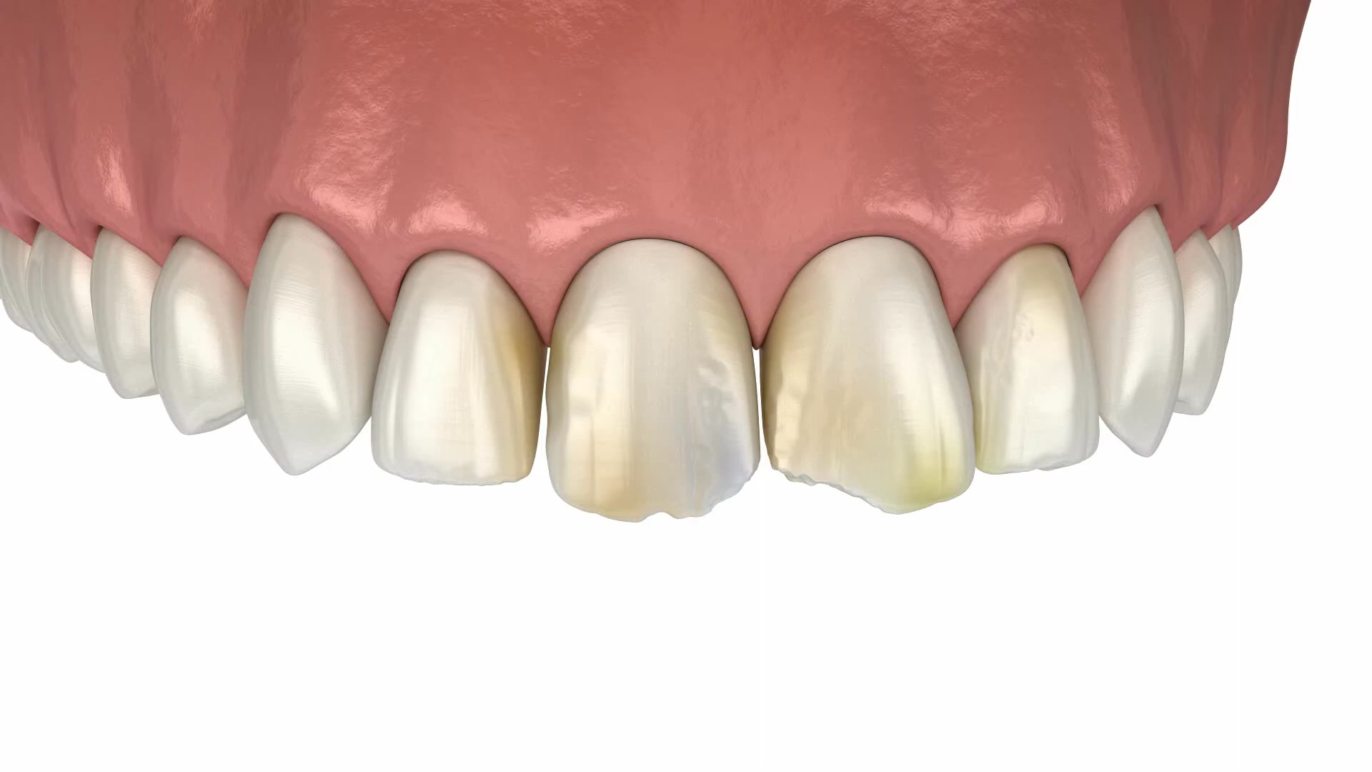 Discover Your Perfect Smile