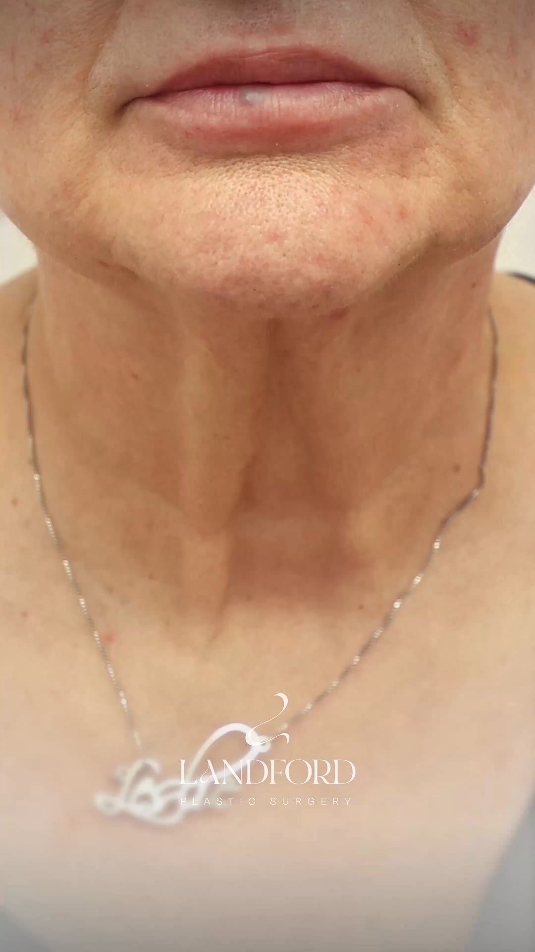 Wilmina Landford, M.D. Med Spa ad creative