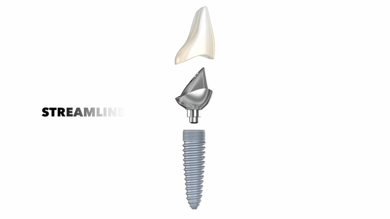 Discover what’s possible—schedule your Dental Implant Consultation!