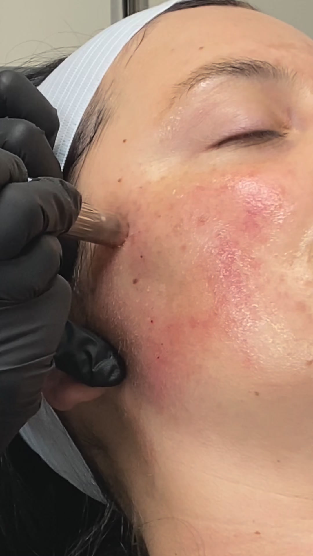 Aligned Aesthetics Med Spa ad creative