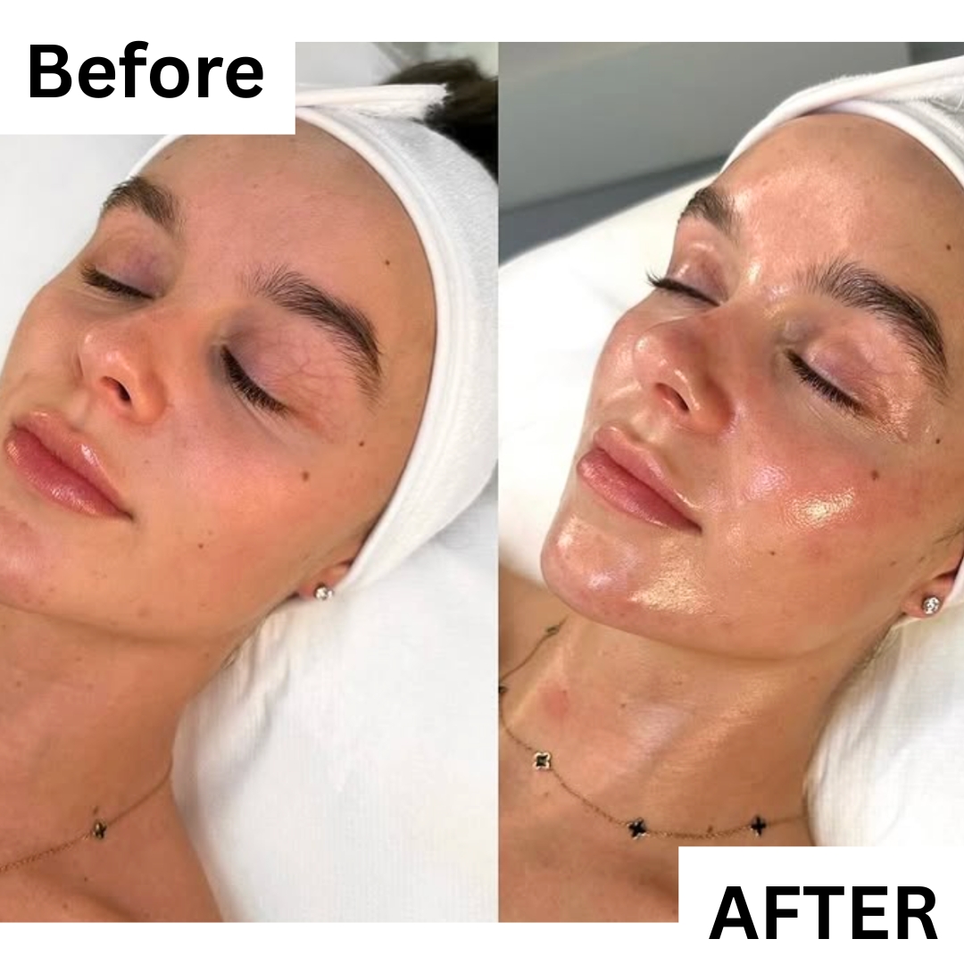 Timeless Spa Center - Chattanooga, TN Med Spa ad creative