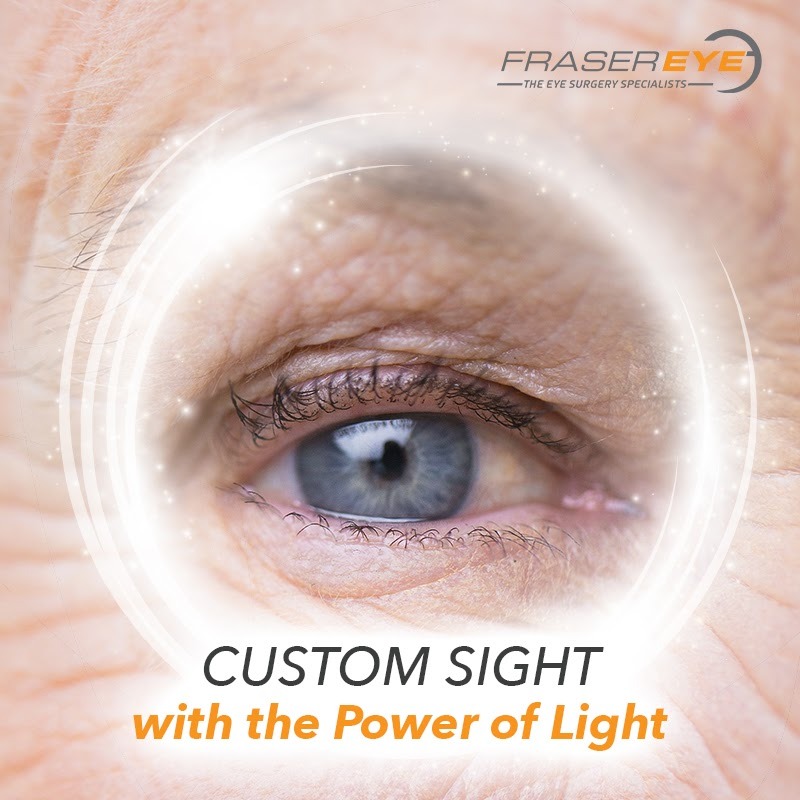 Fraser Eye Care Center Optometrist ad creative