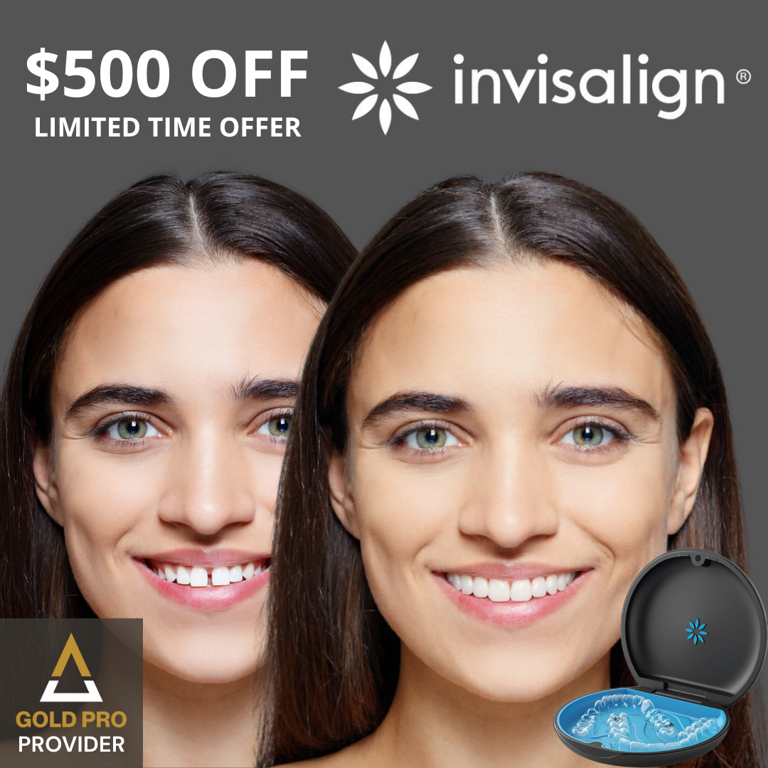 Get $500 OFF Invisalign and FREE Teeth Whitening With Treatment. Limited Time Offer.