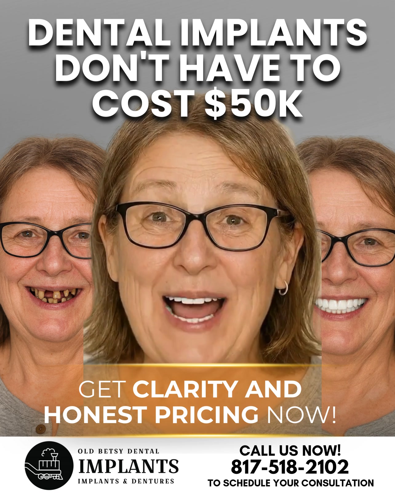 Clear Pricing on Dental Implants