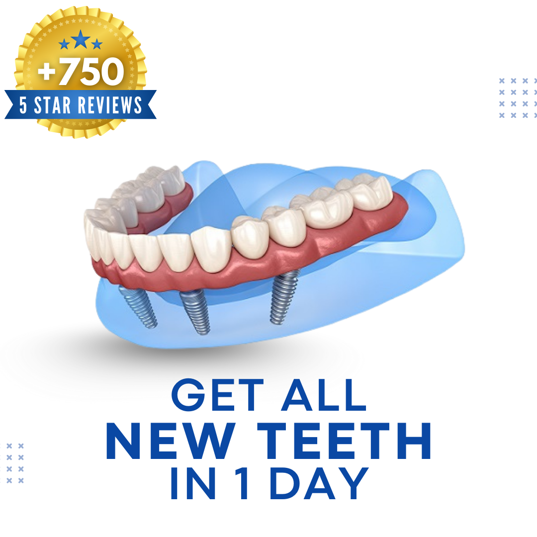 Memphis Dentures and Implants Implant Dentist ad creative