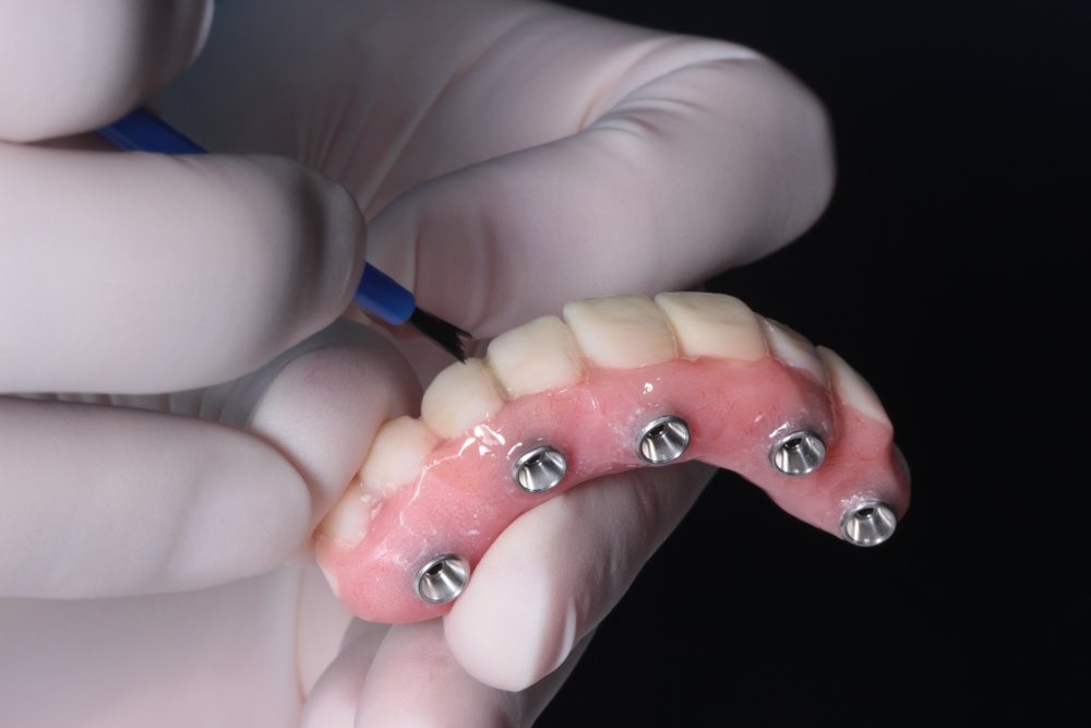 Limited to 50 Patients: Snap in Denture Discount Program!😍