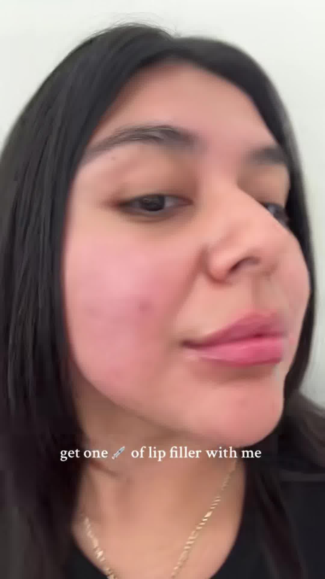 Renove Medical Spa Med Spa ad creative