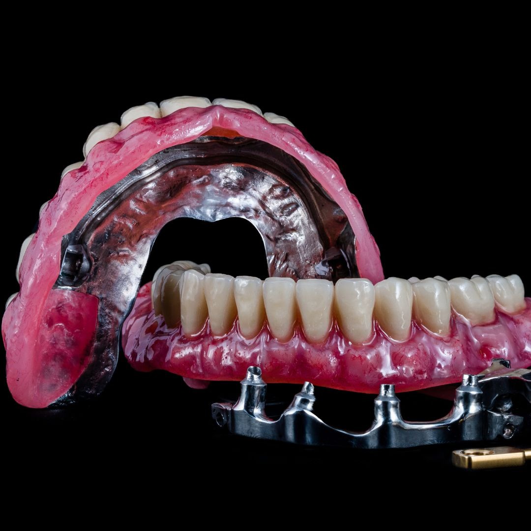 The Dental Boutique Fort Myers Implant Dentist ad creative