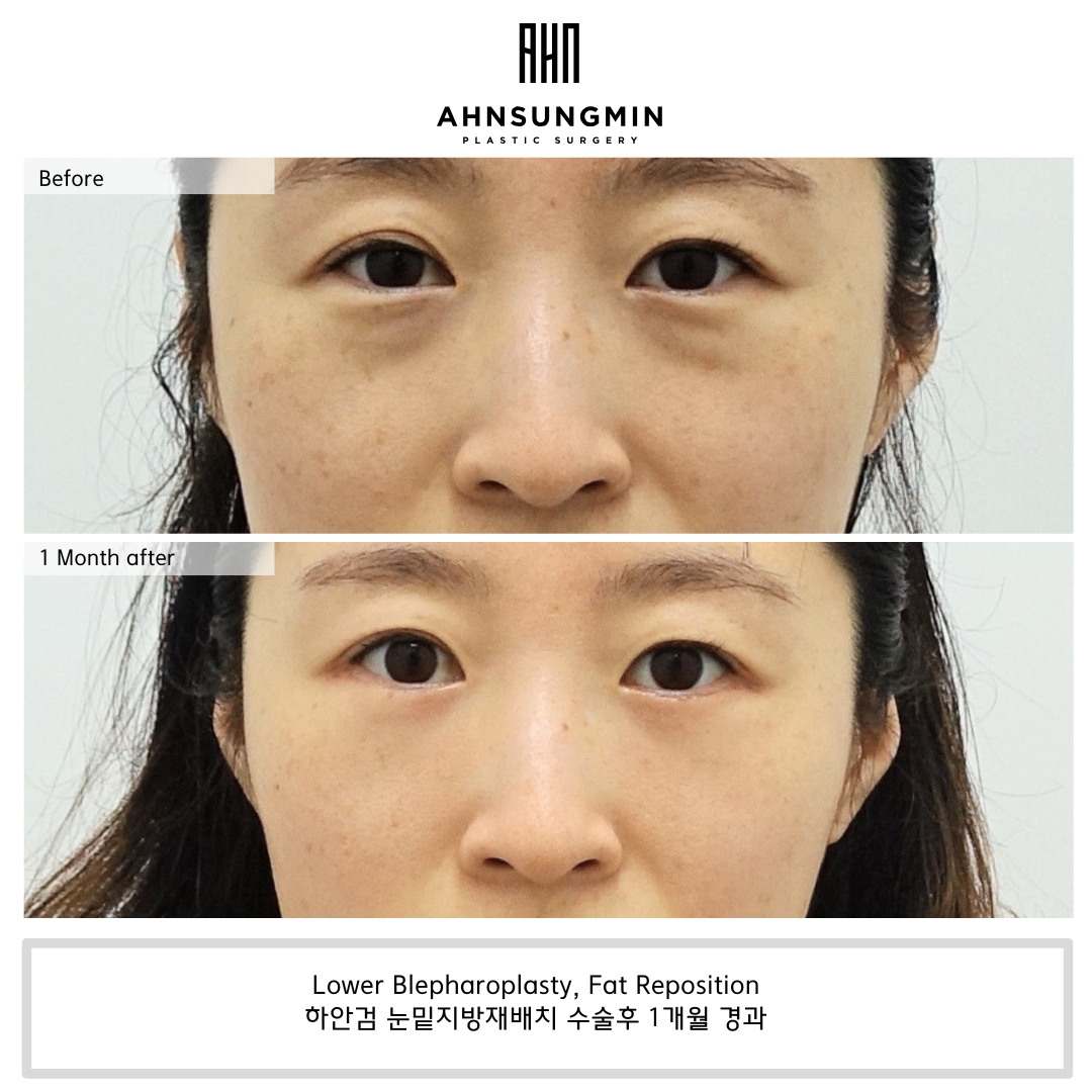Ahn Sung Min Plastic Surgery Med Spa ad creative