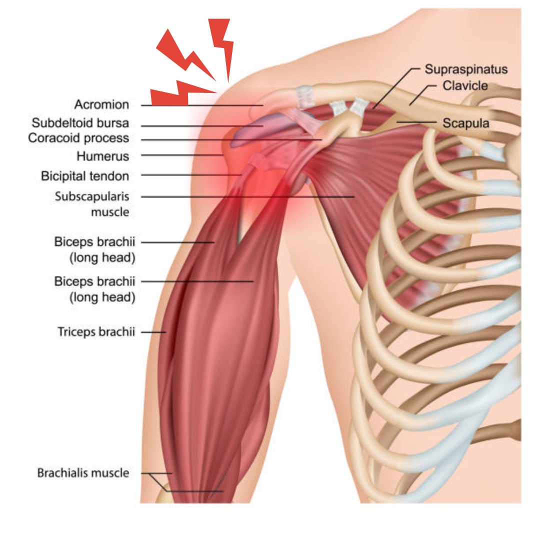 Train Pain-Free: Get Answers for Shoulder Pain ($97 Diagnostic)