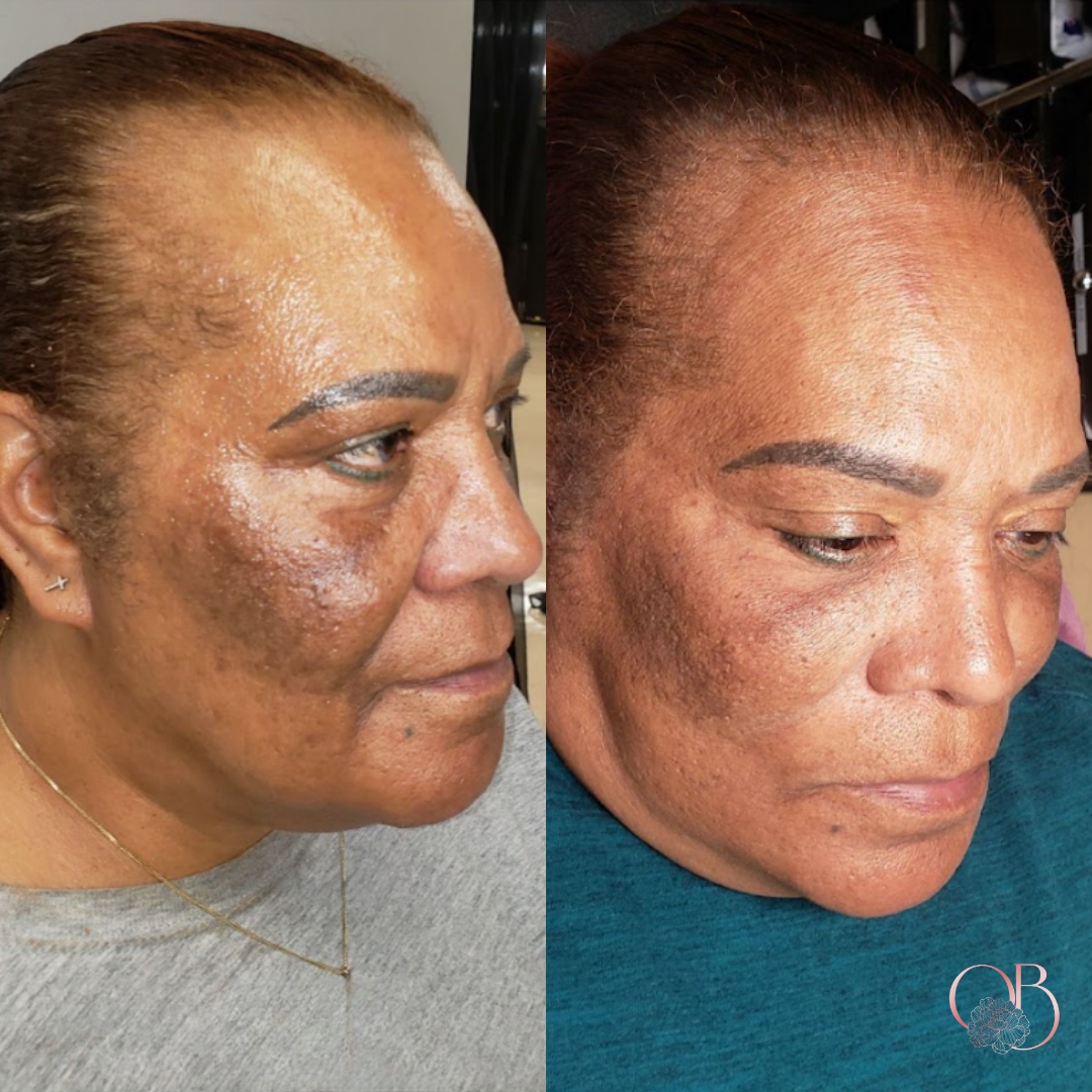 Officially Bougie LLC Med Spa ad creative