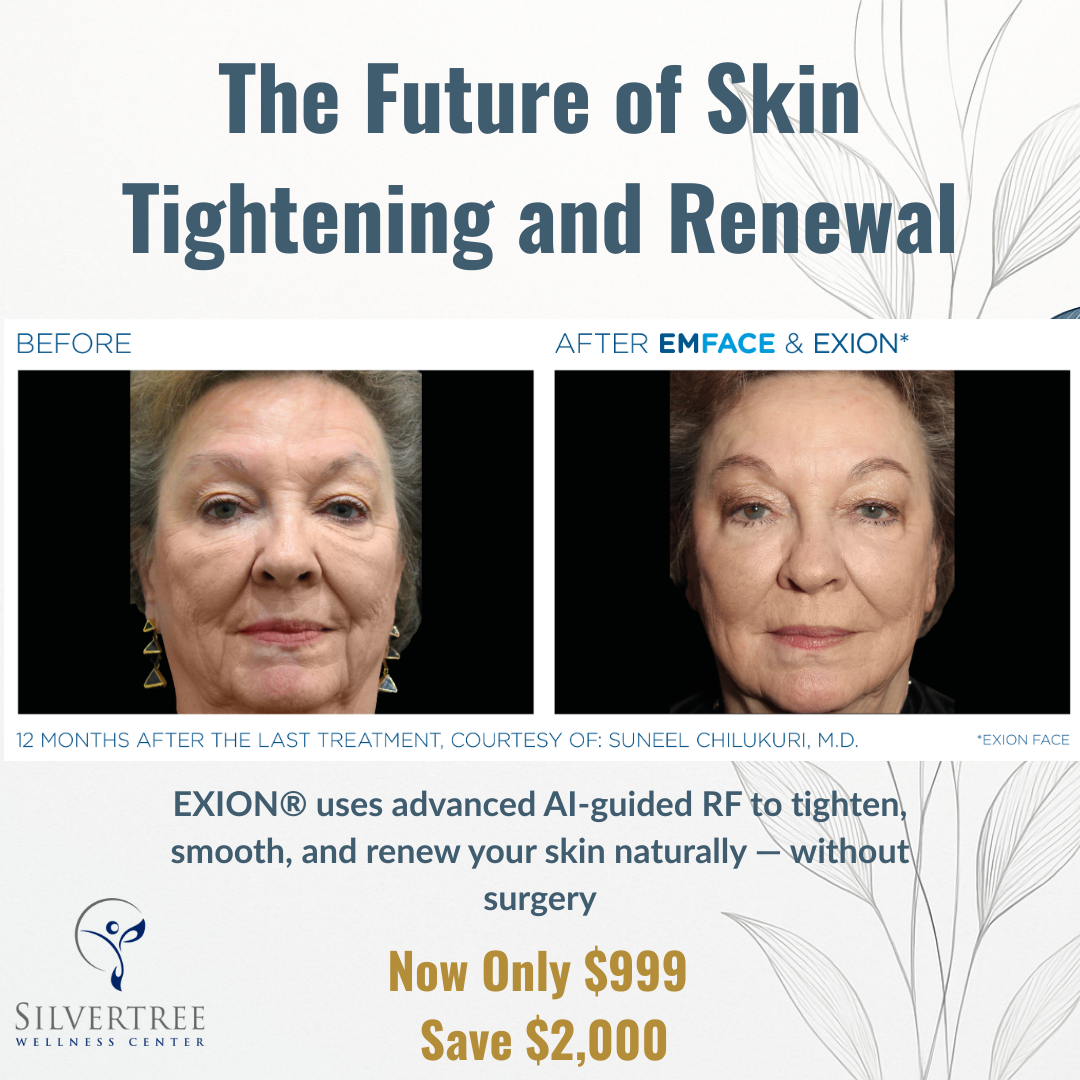 Claim Your EXION® 3-for-1 Voucher