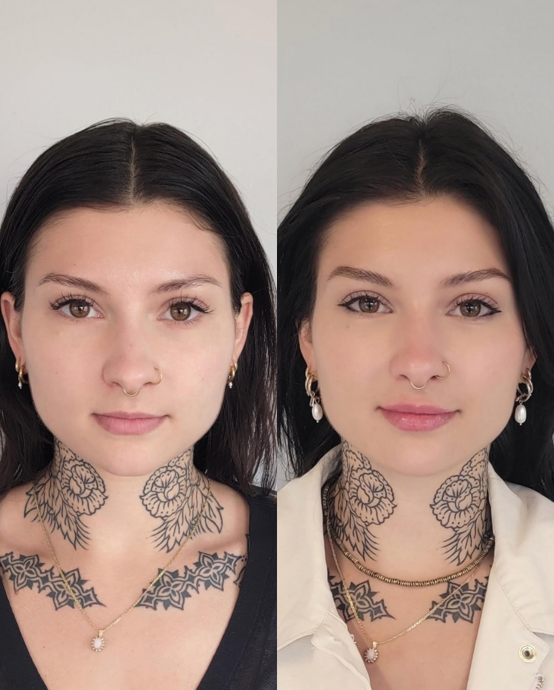 Cheeky Denver Med Spa ad creative