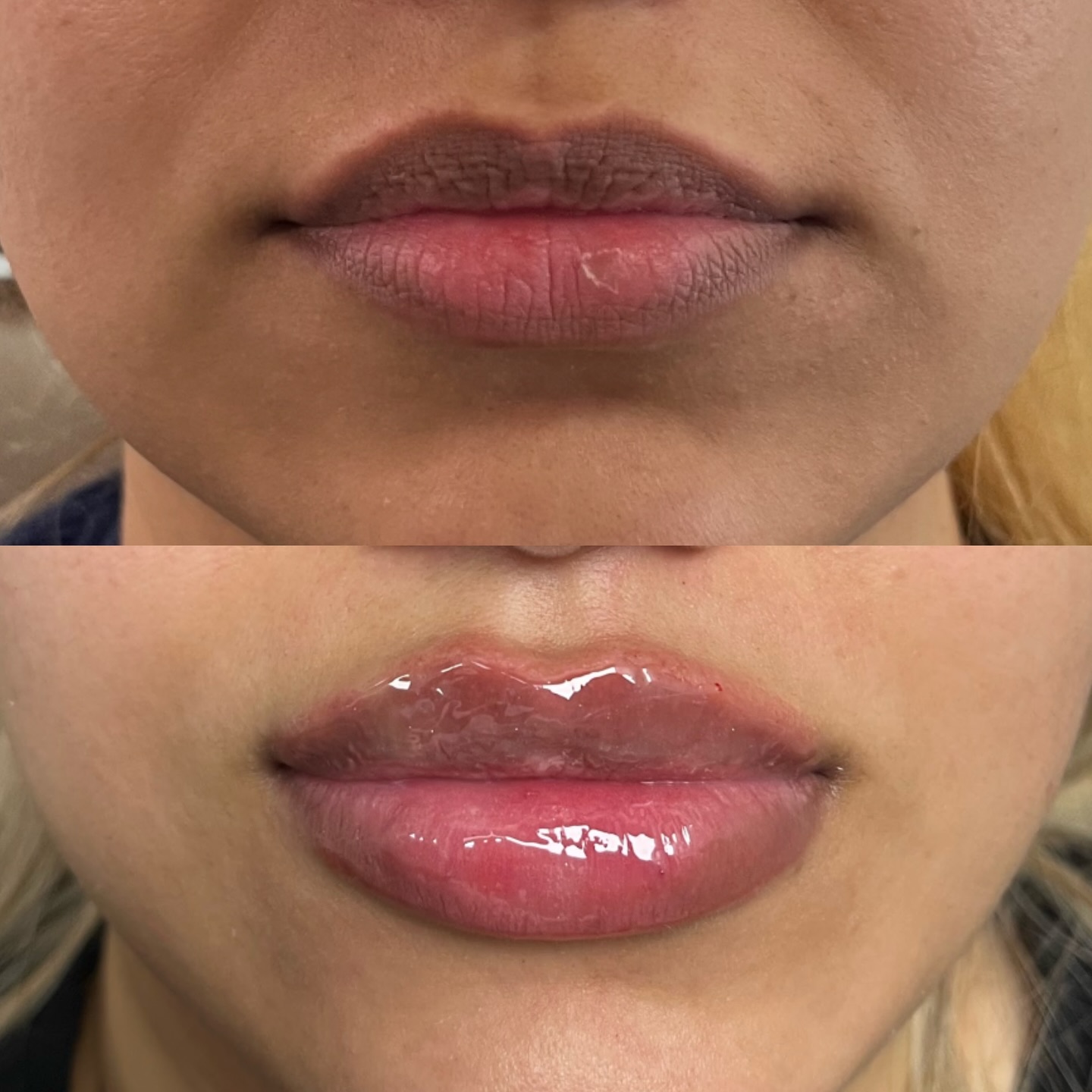 Beauty Health MedSpa Med Spa ad creative