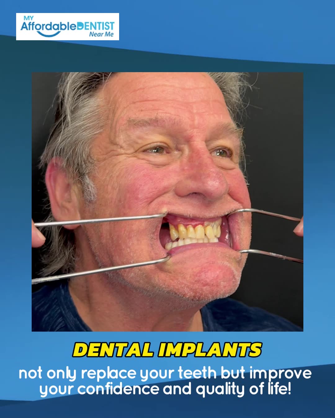 Affordable Dentist Near Me - Dentist in Fort Worth Implant Dentist ad creative