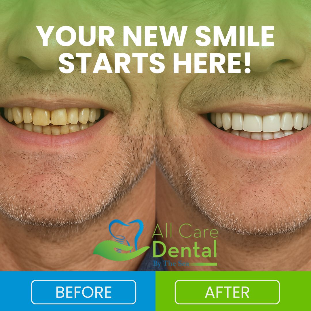 Limited Offer: $525 OFF Dental Implants + Free Consult