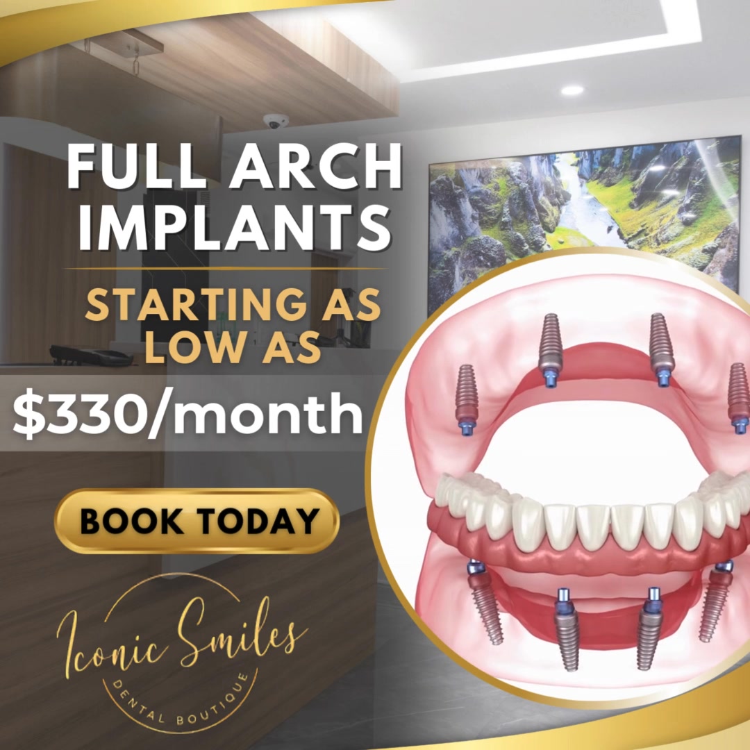 Life-Changing Dental Implants