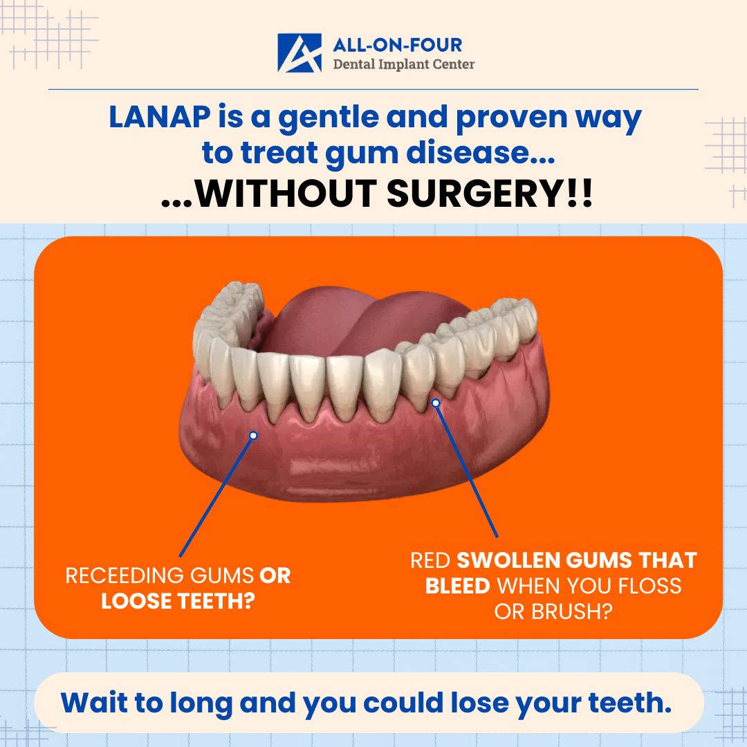 Say Goodbye to Gum Disease Without Traditional Surgery