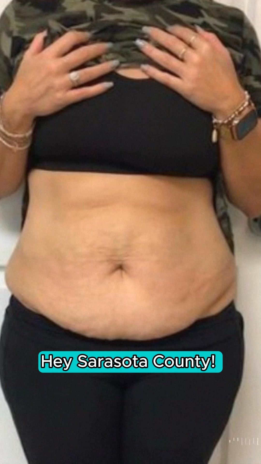 Lux Wellness Co.- Venice, FL Med Spa ad creative