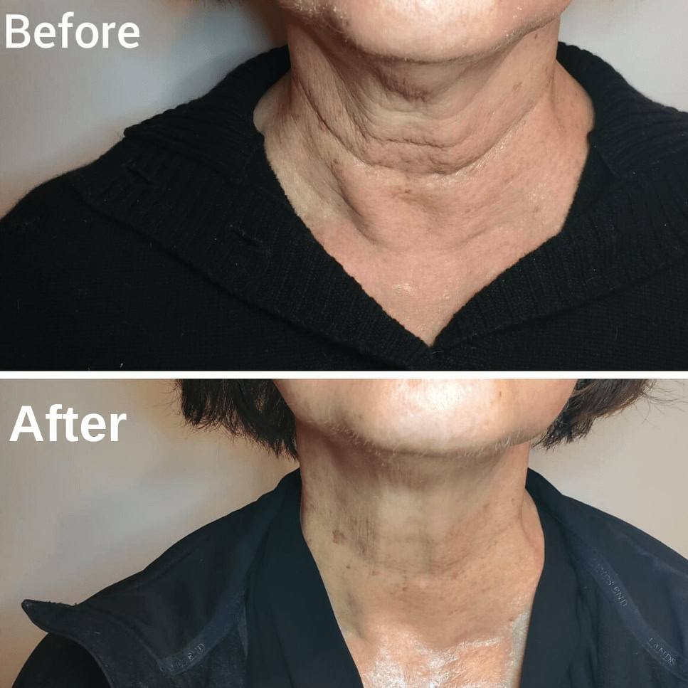 Integrated Restorative Massage Therapy LLC Med Spa ad creative