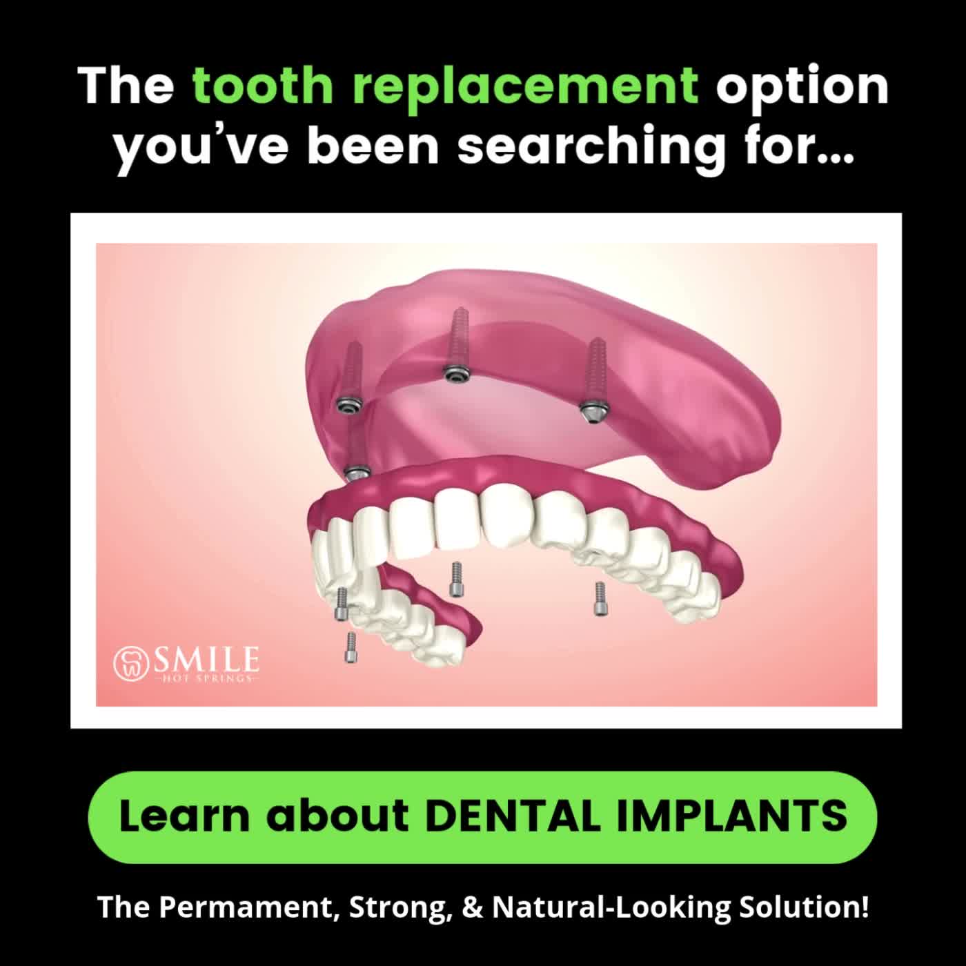 Smile Hot Springs Implant Dentist ad creative