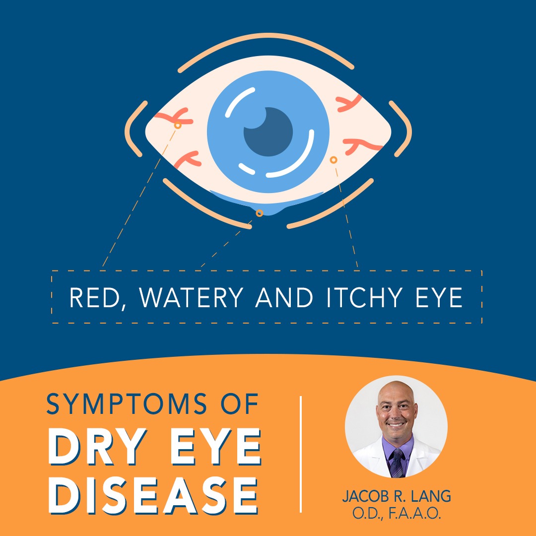 Try Our Dry Eye Self Test