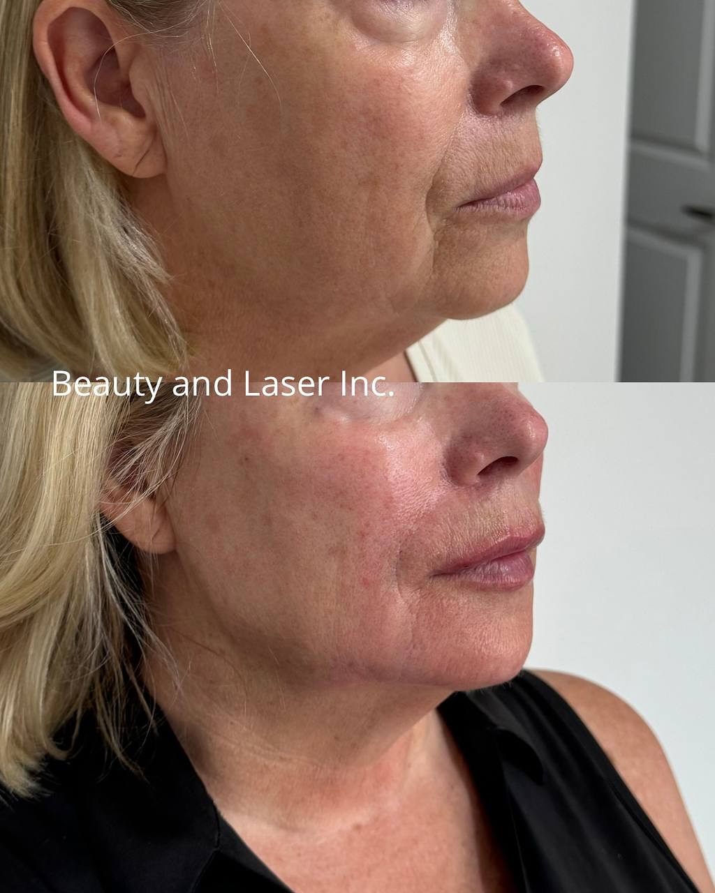 Beauty and Laser Inc. Med Spa ad creative