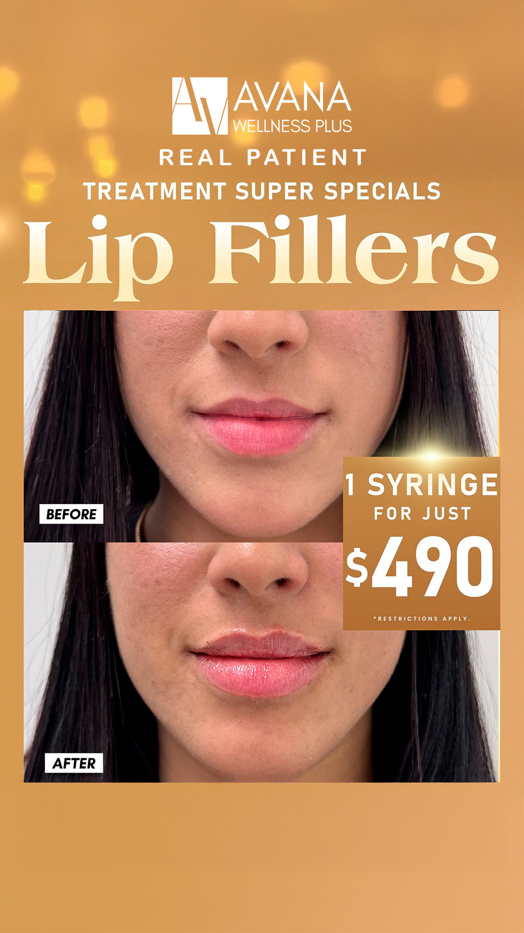 Bodybyavana Med Spa ad creative