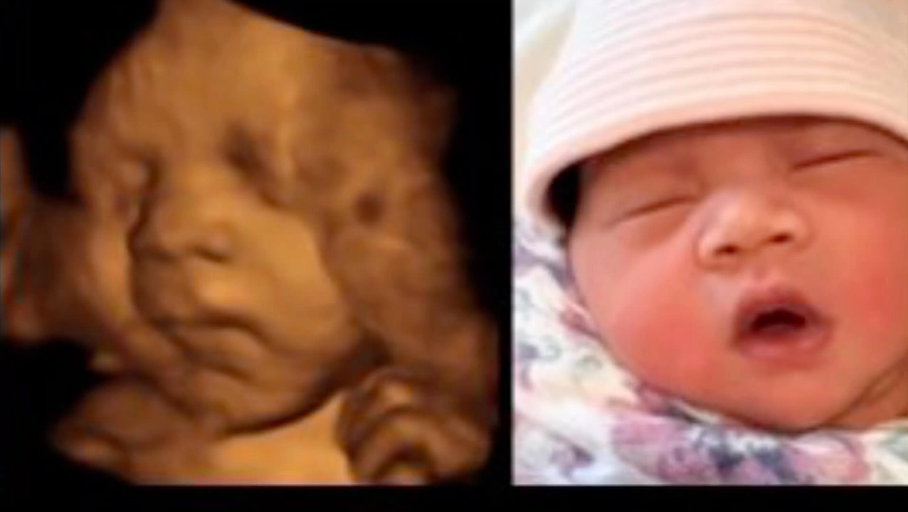 GoldenView Ultrasound San Antonio Dermatologist ad