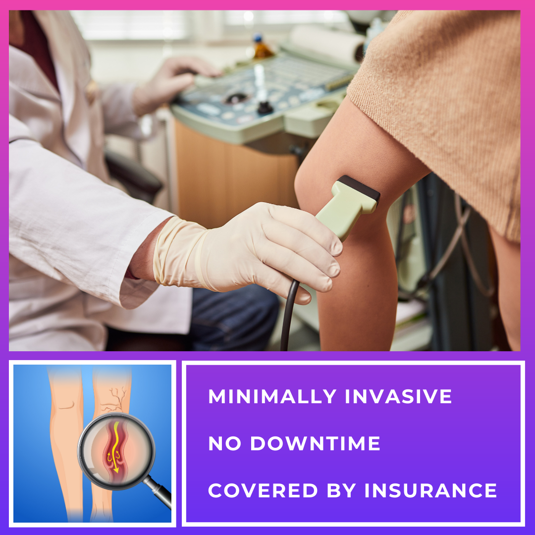 Get Your FREE In-Person Vein Screening