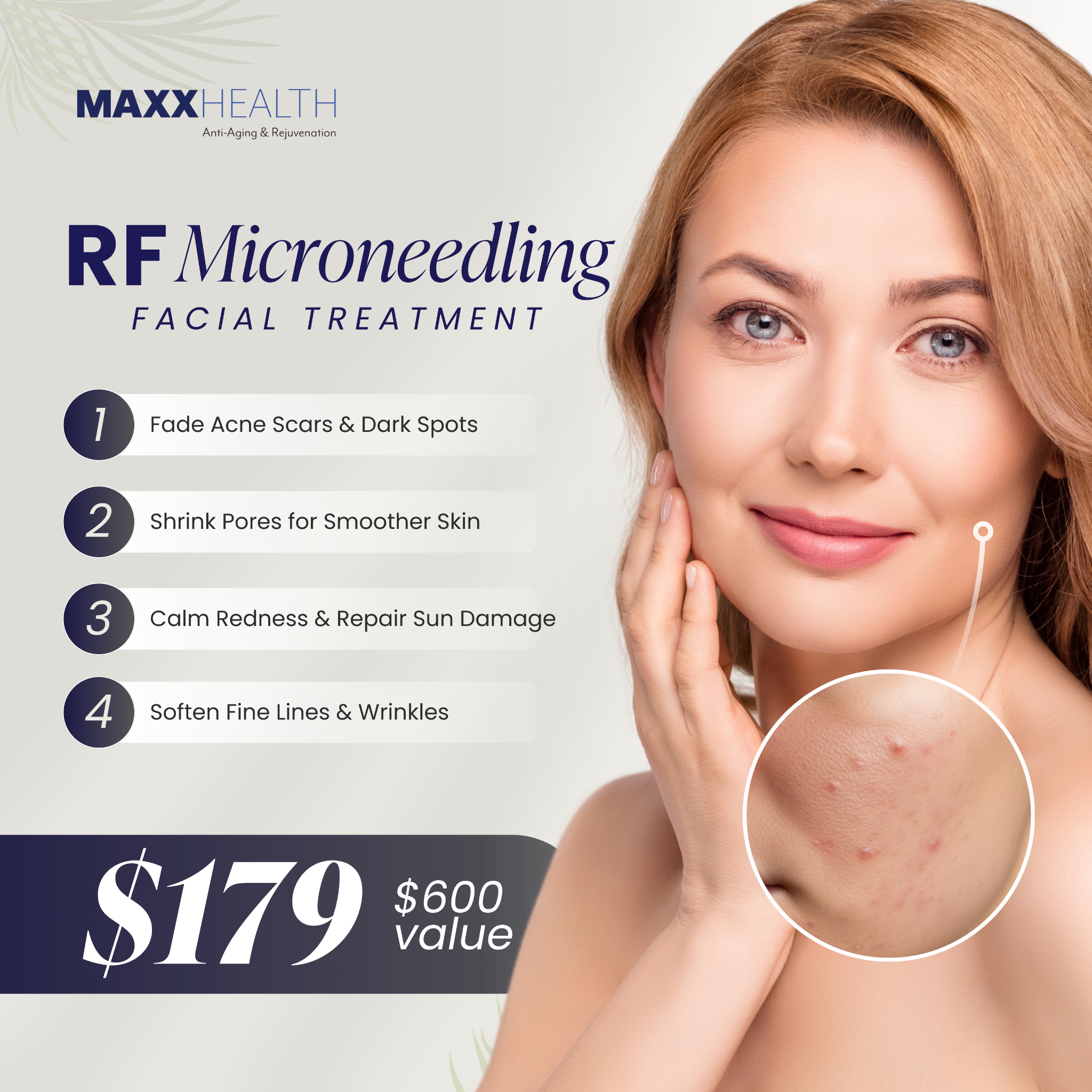 MAXX Health Clinics - The Villages, FL Med Spa ad creative